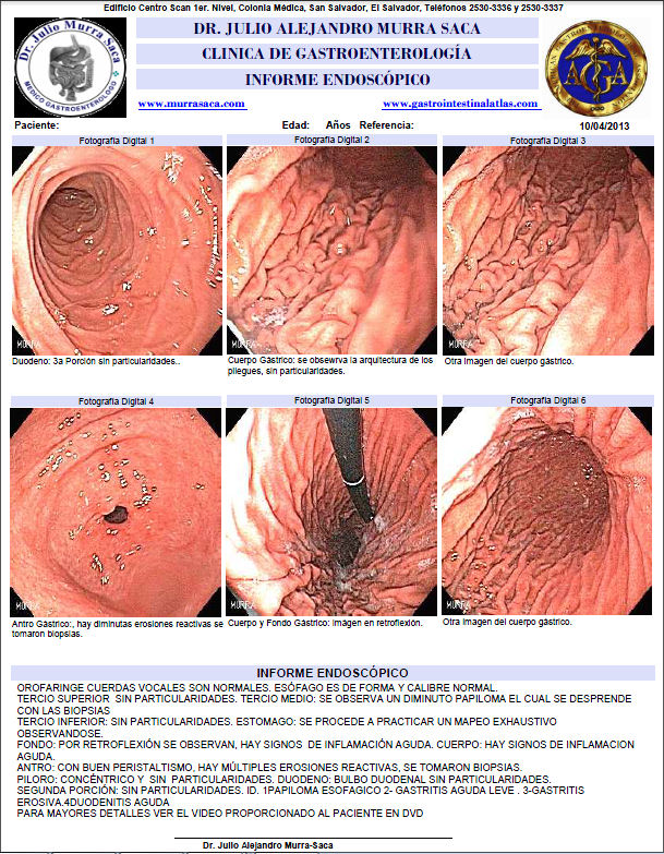 Gastroenterologo Santa Tecla